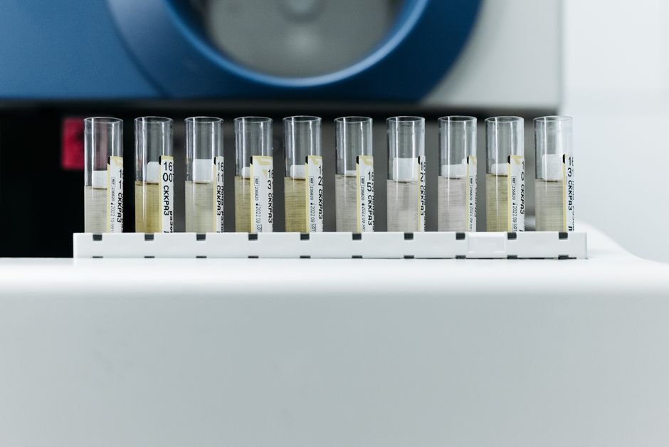 Substituted Drug Tests Fall to 0.03% in Quest Data, but Invalid Results Hold at 0.43%